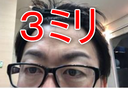 まゆ毛に3ミリのバリカンを入れた男性の画像