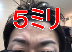 5ミリのバリカンを入れたまゆ毛の画像