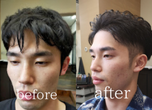 男性の眉施術前眉施術後の画像